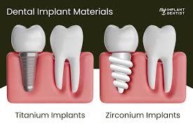 Implants Material Quality