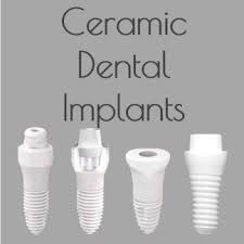 ceramic dental implants cost